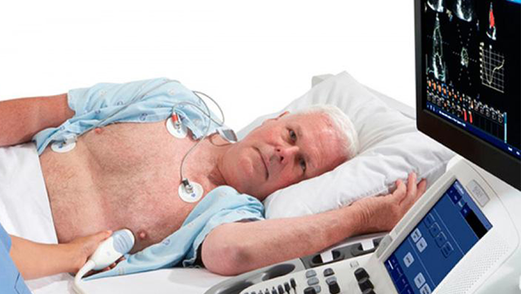 Ecocardiograma c/ Doppler Colorido