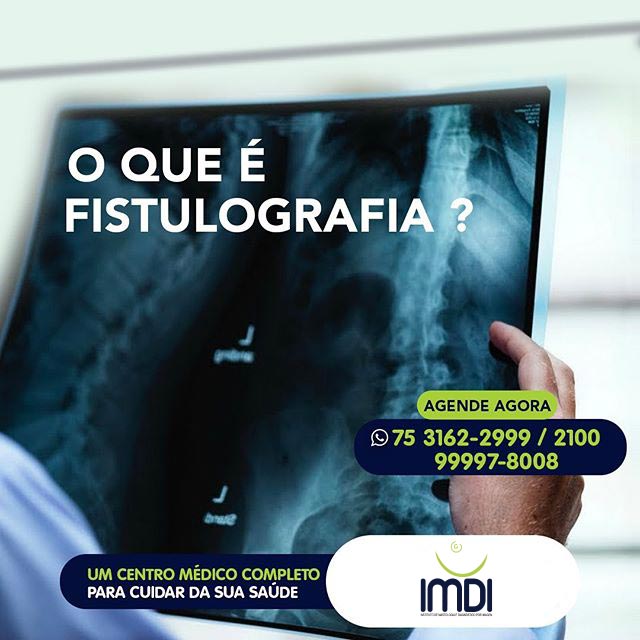 O que é Fistulografia