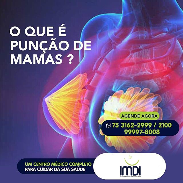 O que é punção de mama